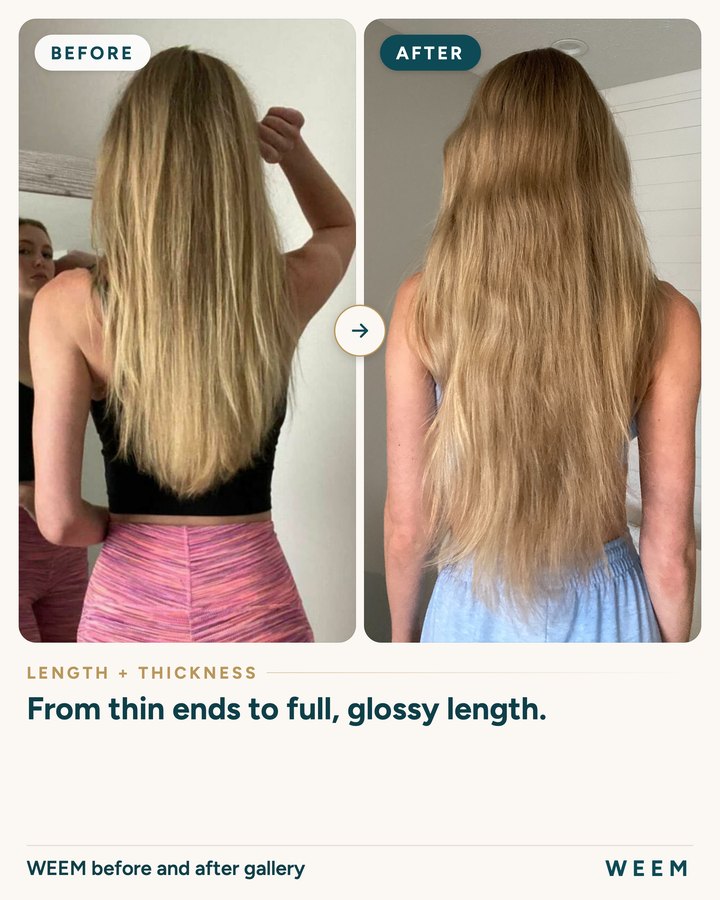 WEEM before and after gallery, before and after (length + thickness): From thin ends to full, glossy length.