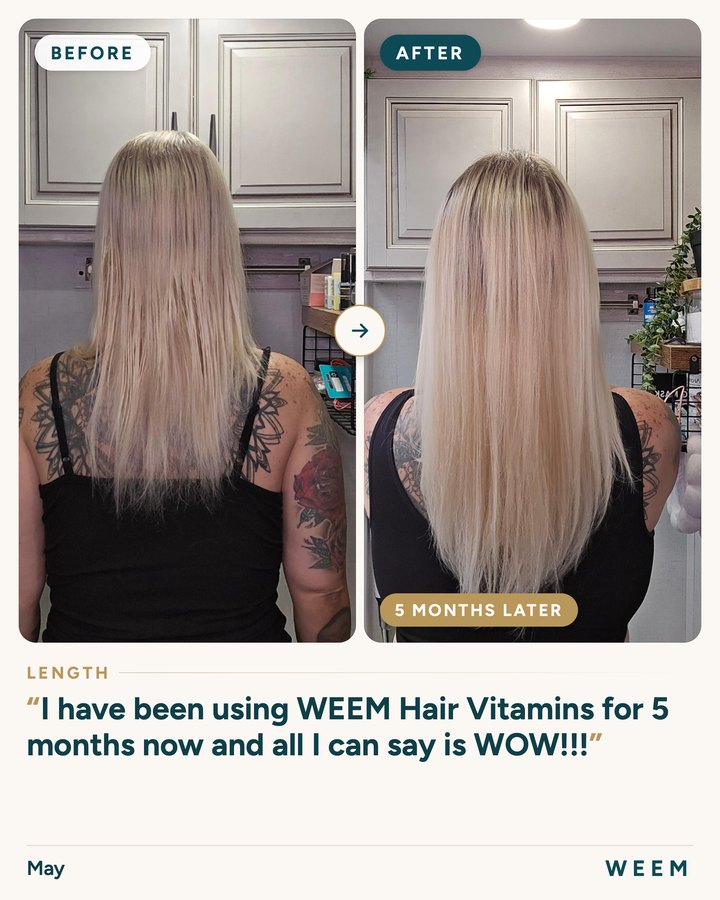 May, before and after (length, 5 months later): I have been using WEEM Hair Vitamins for 5 months now and all I can say is WOW!!!
