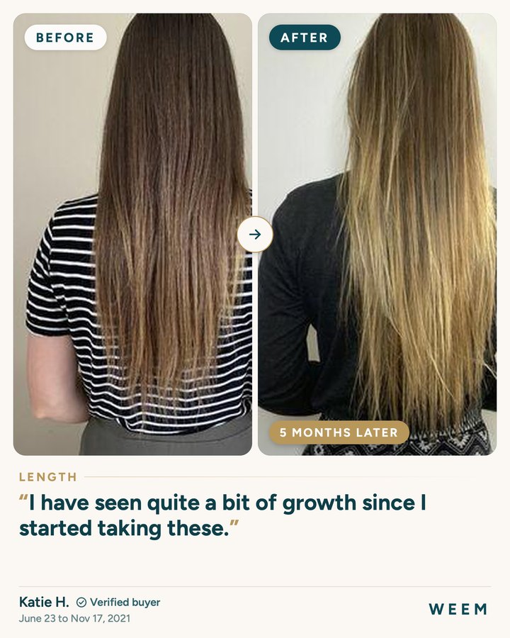 Katie H., before and after (length, 5 months later): I have seen quite a bit of growth since I started taking these.
