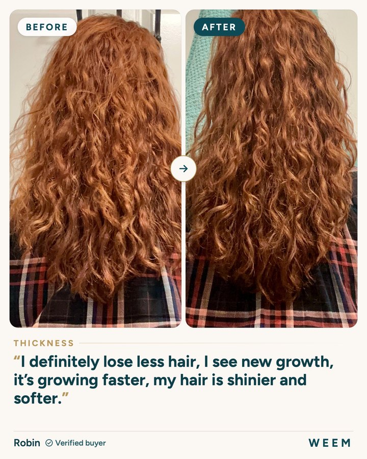 Robin, before and after (thickness): I definitely lose less hair, I see new growth, it’s growing faster, my hair is shinier and softer.