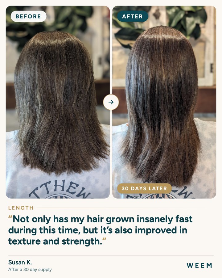 Susan K., before and after (length, 30 days later): Not only has my hair grown insanely fast during this time, but it’s also improved in texture and strength.