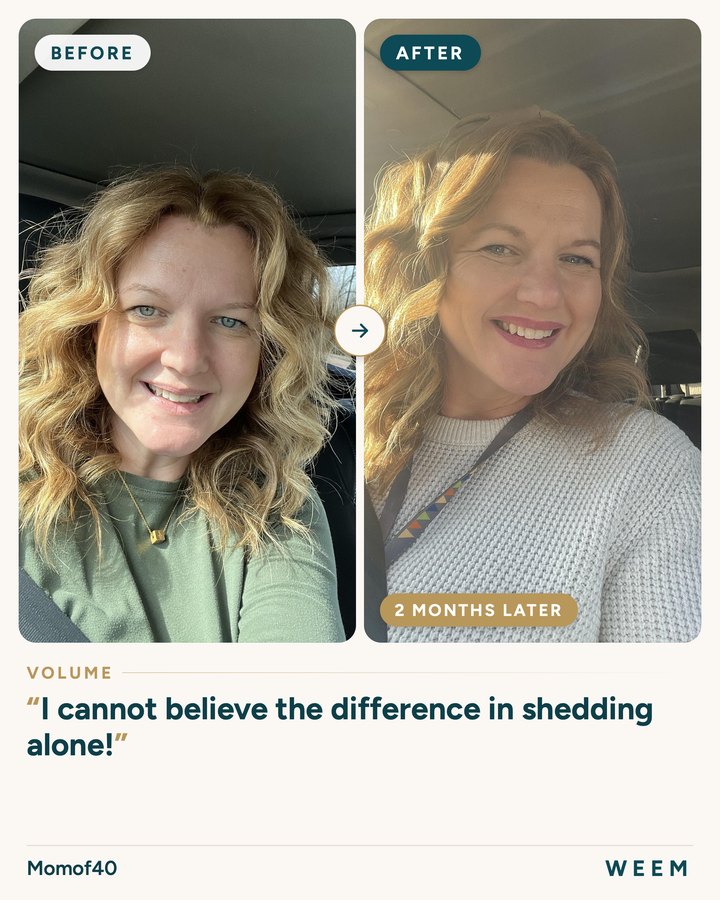 Momof40, before and after (volume, 2 months later): I cannot believe the difference in shedding alone!