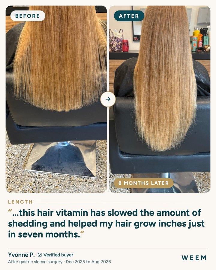Yvonne P., before and after (length, December 2025 to August 2026, after gastric sleeve surgery): this hair vitamin has slowed the amount of shedding and helped my hair grow inches just in seven months.