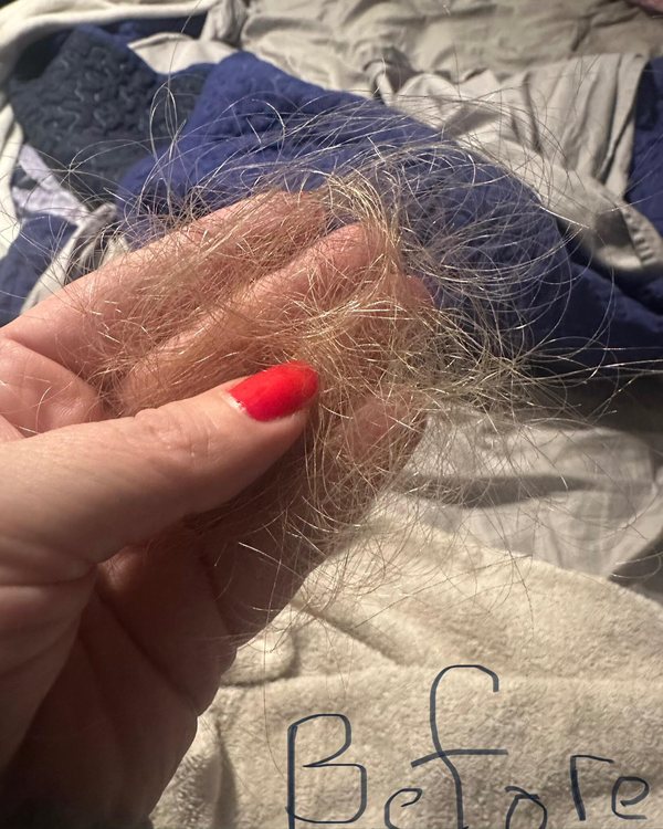 Tina’s shed hair in her hand, before WEEM