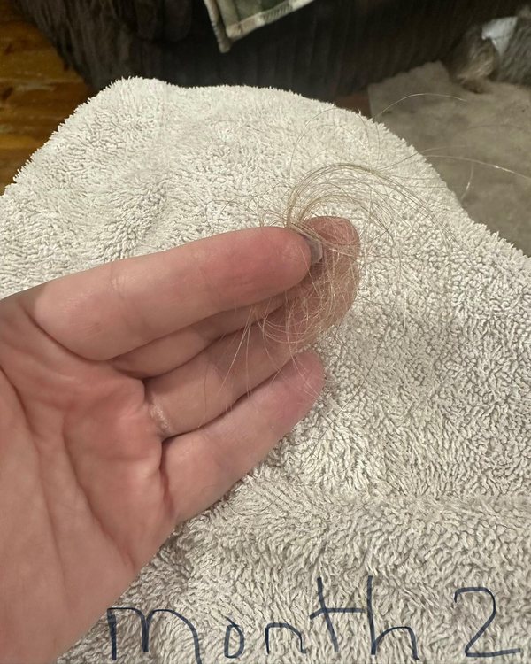 Tina’s shed hair at month 2 on WEEM